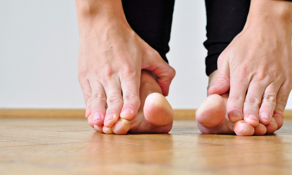 Splay Foot Symptoms And Treatment Exercises Footfiles