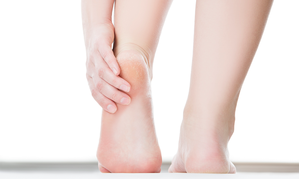 How to Get Rid of Dead Skin on Feet: Step by Step Guide - Cushy Spa