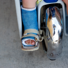 Child Wearing a Foot Brace