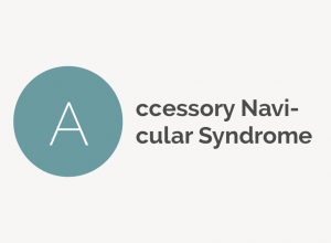Accessory Navicular Syndrome Definition 