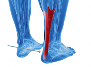 Achilles Tendonitis