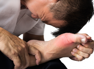 Arthritis Arthritis
