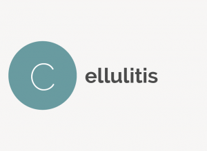 Cellulitis Definition 