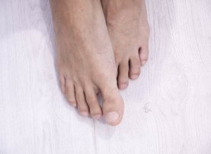 Digital Clubbing Digital Clubbing Symptoms and Causes