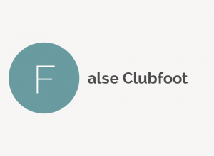 False Clubfoot Definition 