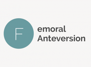 Femoral Anteversion Definition 