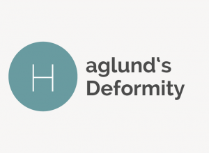 Haglund&#039;s Deformity Definition 