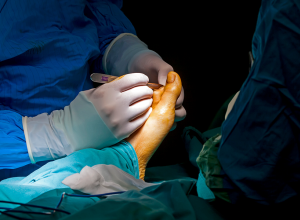 Cheilectomy Surgery: What It Is, What To Expect