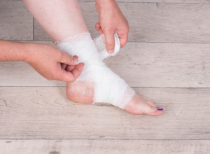 How to Treat an Injured Ankle or Ankle Sprain 