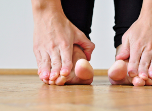 Splay Foot Symptoms And Treatment Exercises