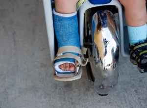 Child Wearing a Foot Brace