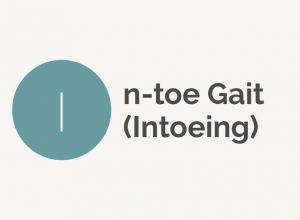 In-toe Gait (Intoeing) Definition 