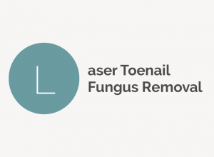 Laser Toenail Fungus Removal 