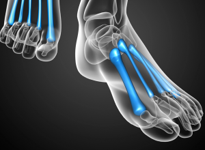 Metatarsal Bones Metatarsal Bones