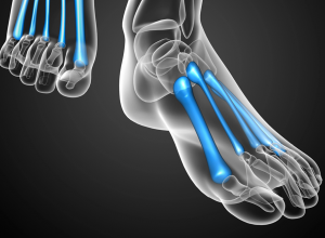 Metatarsal Bones