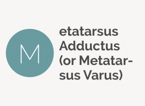 Metatarsus Adductus or Metatarsus Varus Defintion 