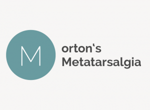 Morton&#039;s Metatarsalgia Definition 