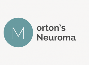 Morton&#039;s Neuroma Definition 