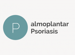 Palmoplantar Psoriasis Definition 