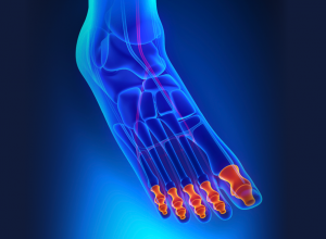 Phalanges Bones in the Toes