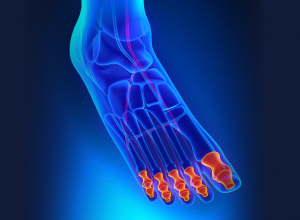 Phalanges: Definition, Location, Bone Anatomy | Footfiles