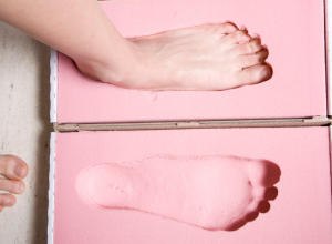 Flat Feet Flat Feet