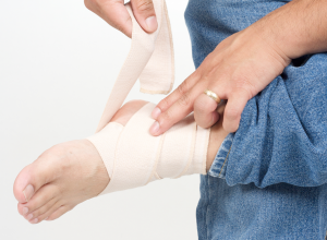 RICE Protocol Ankle Wrapped Using RICE Protocol