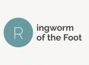 Ringworm of the Foot Definition 
