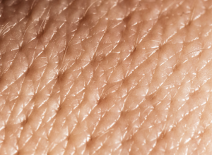 Epidermis