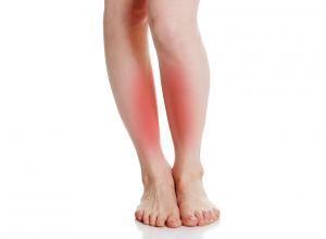 Shin Splint Shin Splint