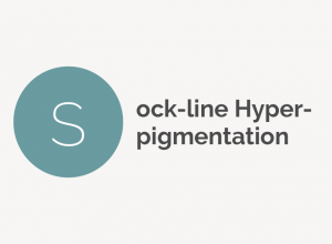 Sock-Line Hyperpigmentation Definition 