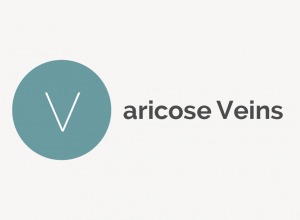 Varicose Veins Definition 