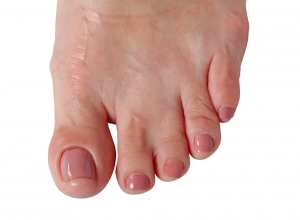 Webbed Toes