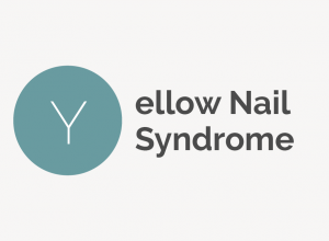 Yellow Nail Syndrome Definition 