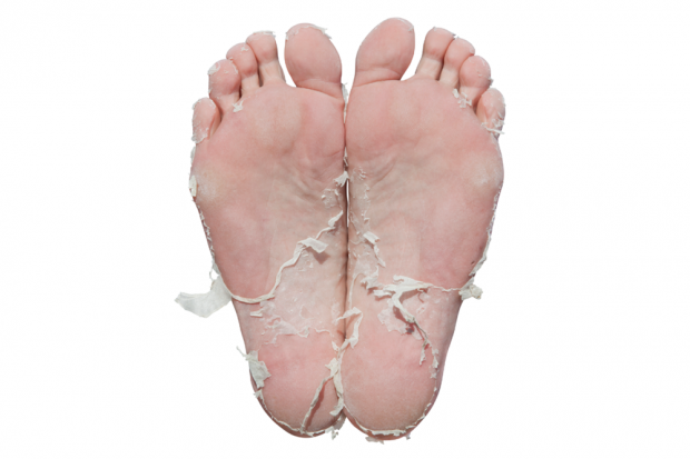 Strange Truth About Baby Foot Peel 