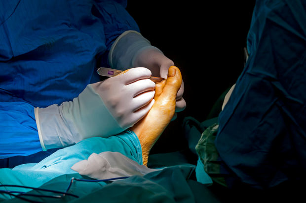 Cheilectomy Surgery: What It Is, What To Expect