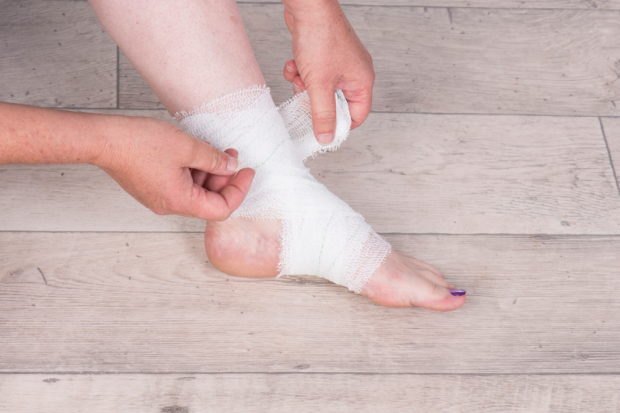 How to Treat an Injured Ankle or Ankle Sprain 